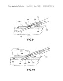 SAFE NEEDLE METHODS, APPARATUS, AND SYSTEMS diagram and image