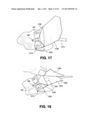 SAFE NEEDLE METHODS, APPARATUS, AND SYSTEMS diagram and image