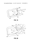 SAFE NEEDLE METHODS, APPARATUS, AND SYSTEMS diagram and image