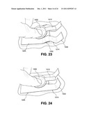 SAFE NEEDLE METHODS, APPARATUS, AND SYSTEMS diagram and image