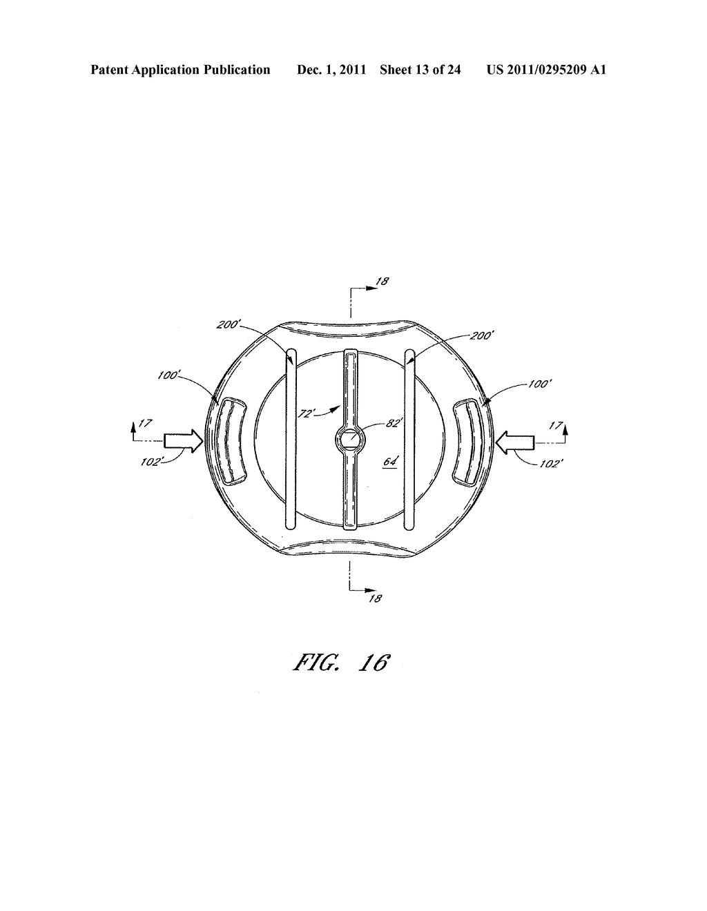 INFUSION SET - diagram, schematic, and image 14