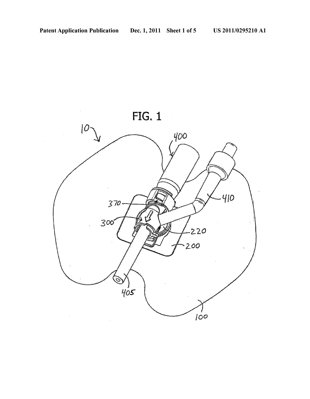 MEDICAL TUBING SECUREMENT ASSEMBLY AND METHODS OF USE - diagram, schematic, and image 02