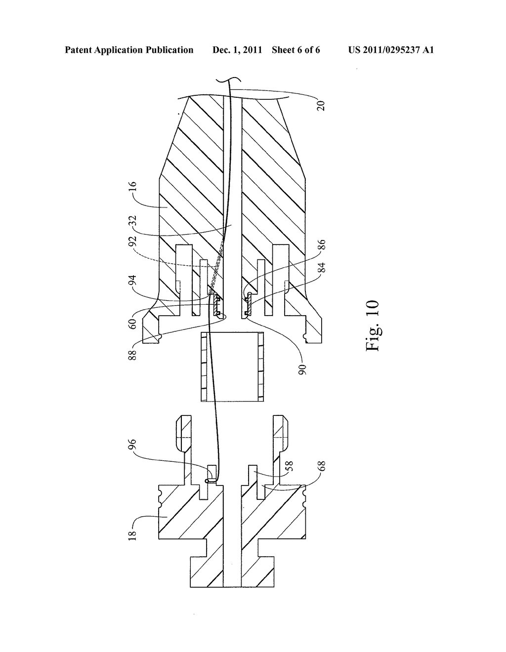 SUTURE WINDING FOR A DRAINAGE CATHETER - diagram, schematic, and image 07