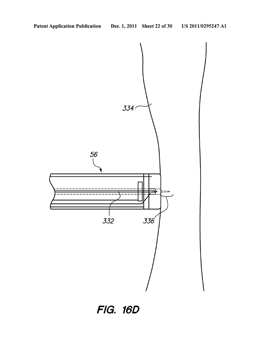 SYSTEM AND METHOD FOR AUTOMATED MINIMALLY INVASIVE THERAPY USING     RADIOMETRY - diagram, schematic, and image 23