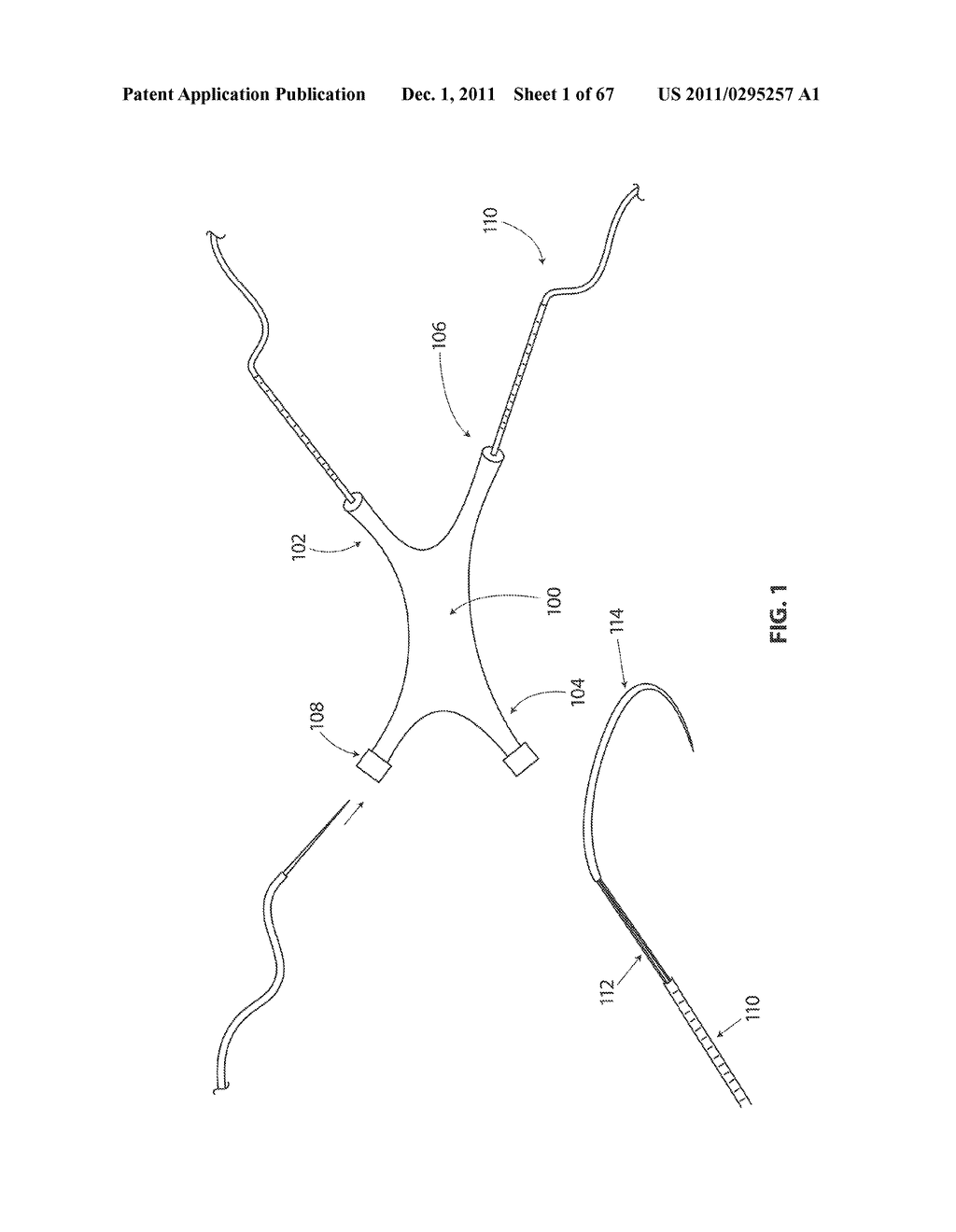 SYSTEMS AND METHODS FOR STERNUM REPAIR - diagram, schematic, and image 02