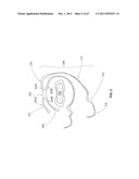 SYSTEMS AND METHODS FOR STERNUM REPAIR diagram and image