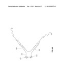 SYSTEMS AND METHODS FOR STERNUM REPAIR diagram and image