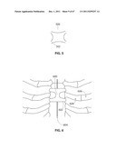 SYSTEMS AND METHODS FOR STERNUM REPAIR diagram and image