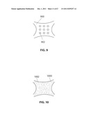 SYSTEMS AND METHODS FOR STERNUM REPAIR diagram and image