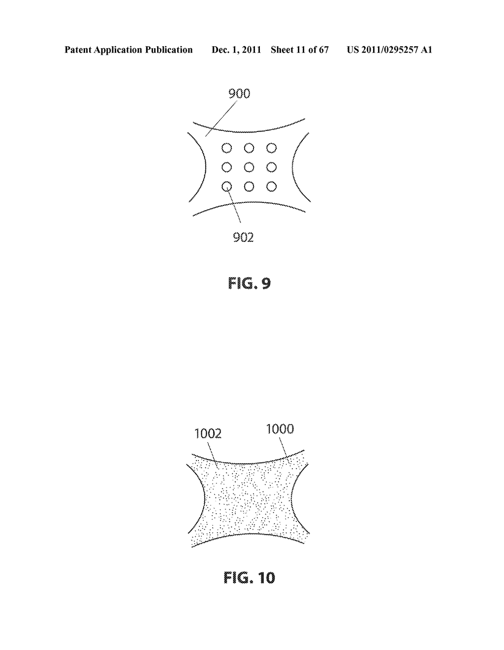 SYSTEMS AND METHODS FOR STERNUM REPAIR - diagram, schematic, and image 12