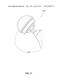 SYSTEMS AND METHODS FOR STERNUM REPAIR diagram and image