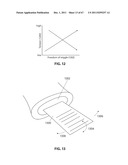 SYSTEMS AND METHODS FOR STERNUM REPAIR diagram and image