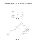 SYSTEMS AND METHODS FOR STERNUM REPAIR diagram and image