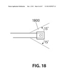 SYSTEMS AND METHODS FOR STERNUM REPAIR diagram and image