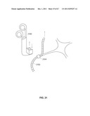 SYSTEMS AND METHODS FOR STERNUM REPAIR diagram and image