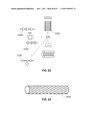 SYSTEMS AND METHODS FOR STERNUM REPAIR diagram and image