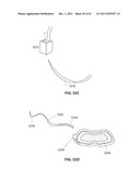 SYSTEMS AND METHODS FOR STERNUM REPAIR diagram and image