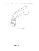 SYSTEMS AND METHODS FOR STERNUM REPAIR diagram and image