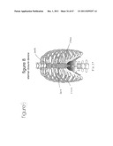 SYSTEMS AND METHODS FOR STERNUM REPAIR diagram and image