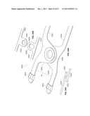 SYSTEMS AND METHODS FOR STERNUM REPAIR diagram and image