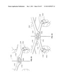 SYSTEMS AND METHODS FOR STERNUM REPAIR diagram and image