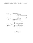 SYSTEMS AND METHODS FOR STERNUM REPAIR diagram and image