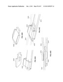 SYSTEMS AND METHODS FOR STERNUM REPAIR diagram and image