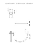 SYSTEMS AND METHODS FOR STERNUM REPAIR diagram and image