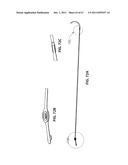 SYSTEMS AND METHODS FOR STERNUM REPAIR diagram and image