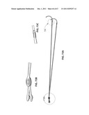 SYSTEMS AND METHODS FOR STERNUM REPAIR diagram and image