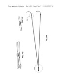 SYSTEMS AND METHODS FOR STERNUM REPAIR diagram and image