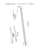 SYSTEMS AND METHODS FOR STERNUM REPAIR diagram and image