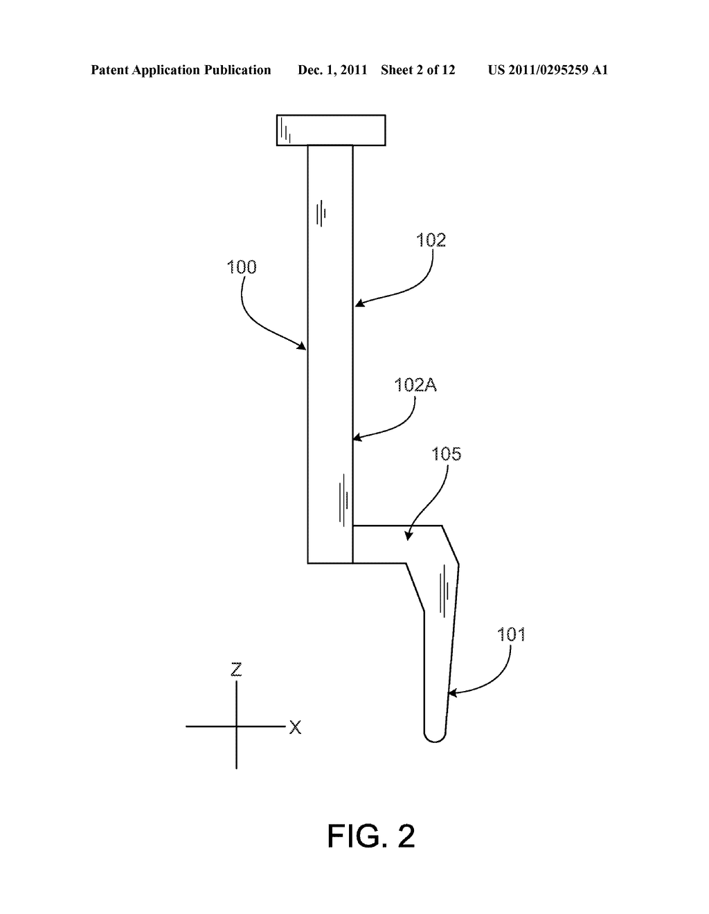 SURGICAL TECHNIQUE AND INSTRUMENTATION FOR MINIMAL HIP ARTHROPLASTY     SURGERY - diagram, schematic, and image 03