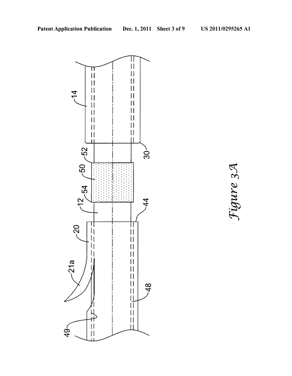 Delivery System Having Stent Retention Structure - diagram, schematic, and image 04