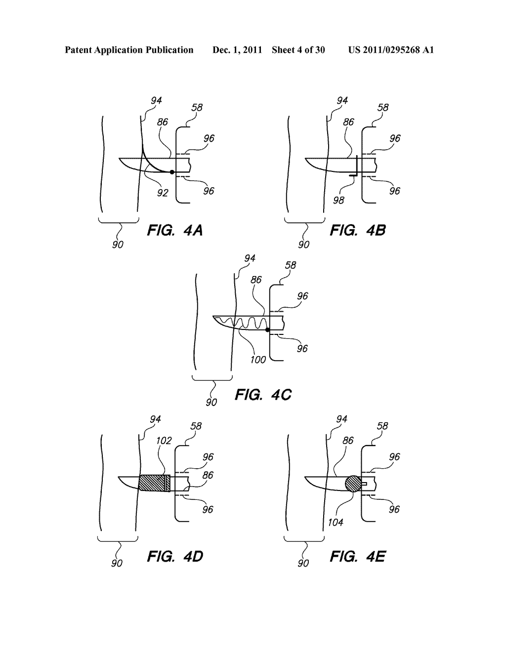 SYSTEM AND METHOD FOR AUTOMATED MASTER INPUT SCALING - diagram, schematic, and image 05