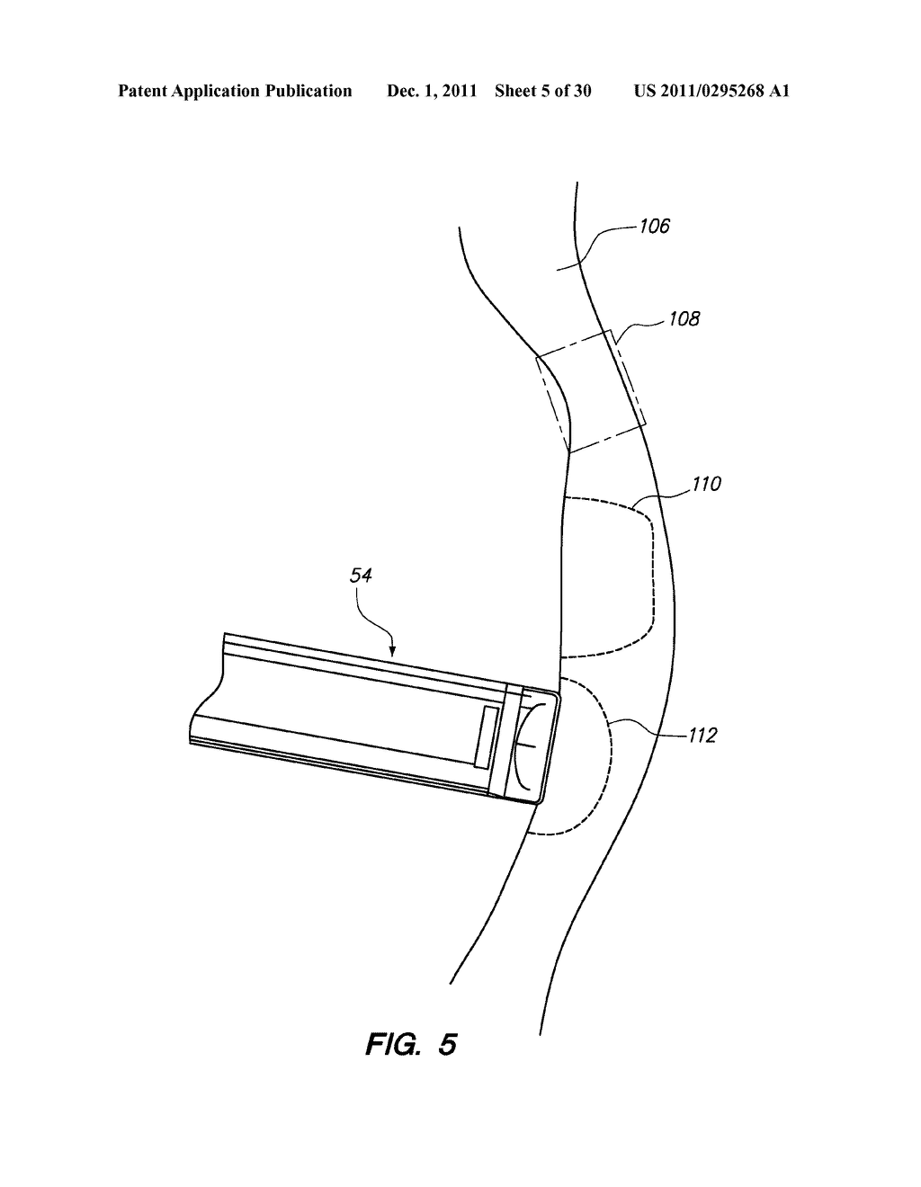 SYSTEM AND METHOD FOR AUTOMATED MASTER INPUT SCALING - diagram, schematic, and image 06