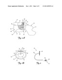 SYSTEM AND METHOD FOR INTERVERTEBRAL DISC BULGE REDUCTION diagram and image