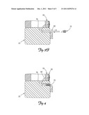 SYSTEM AND METHOD FOR INTERVERTEBRAL DISC BULGE REDUCTION diagram and image