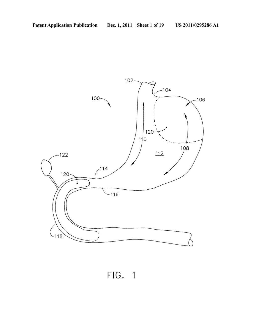 METHODS AND DEVICES FOR REGULATING THE ACTIVATION OF GHRELIN HORMONES     WITHIN A STOMACH - diagram, schematic, and image 02