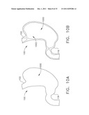 METHODS AND DEVICES FOR REGULATING THE ACTIVATION OF GHRELIN HORMONES     WITHIN A STOMACH diagram and image