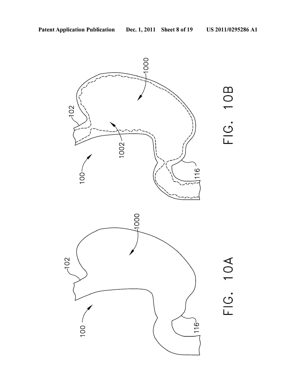 METHODS AND DEVICES FOR REGULATING THE ACTIVATION OF GHRELIN HORMONES     WITHIN A STOMACH - diagram, schematic, and image 09