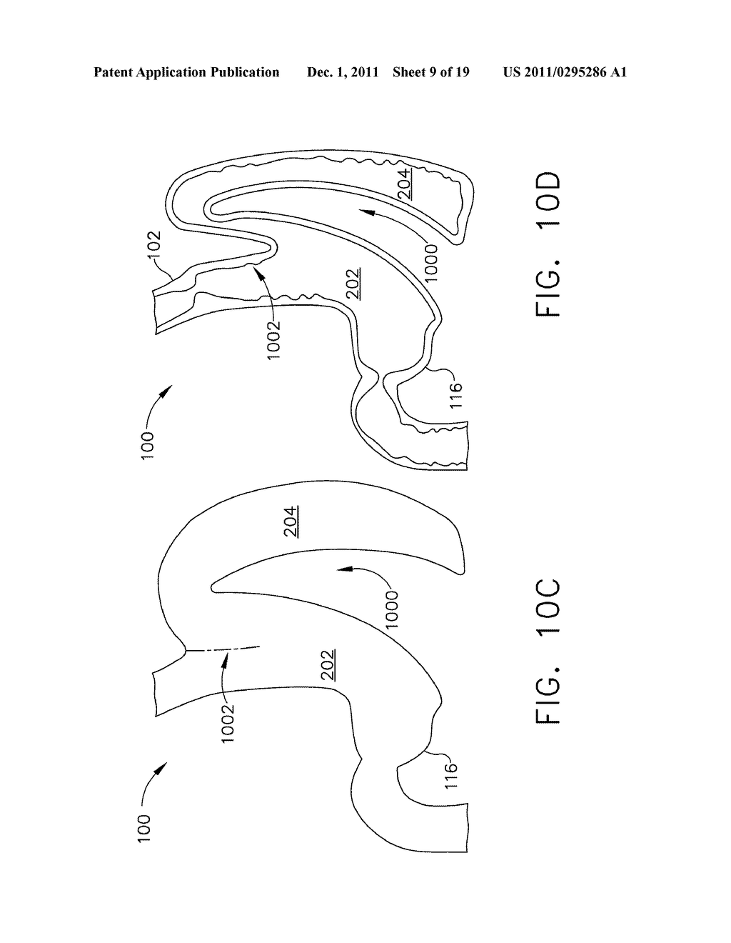 METHODS AND DEVICES FOR REGULATING THE ACTIVATION OF GHRELIN HORMONES     WITHIN A STOMACH - diagram, schematic, and image 10