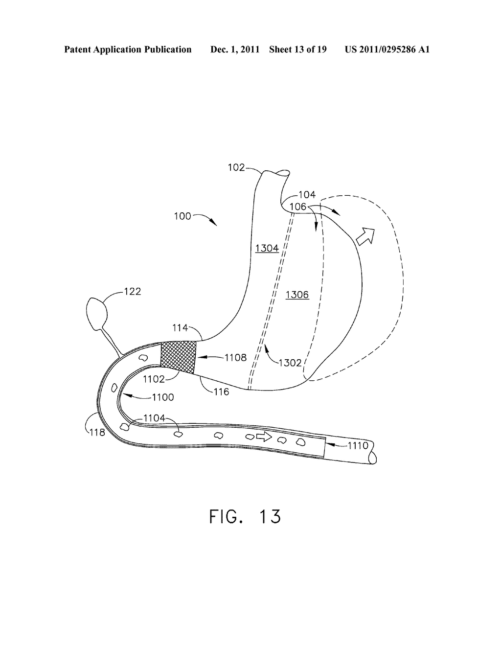 METHODS AND DEVICES FOR REGULATING THE ACTIVATION OF GHRELIN HORMONES     WITHIN A STOMACH - diagram, schematic, and image 14