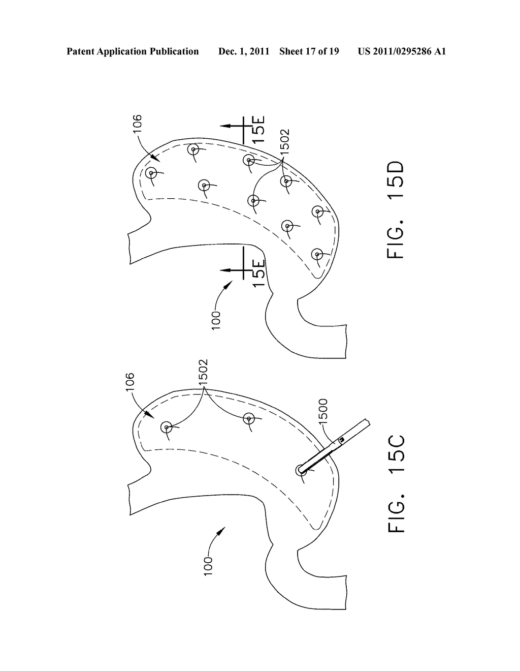 METHODS AND DEVICES FOR REGULATING THE ACTIVATION OF GHRELIN HORMONES     WITHIN A STOMACH - diagram, schematic, and image 18