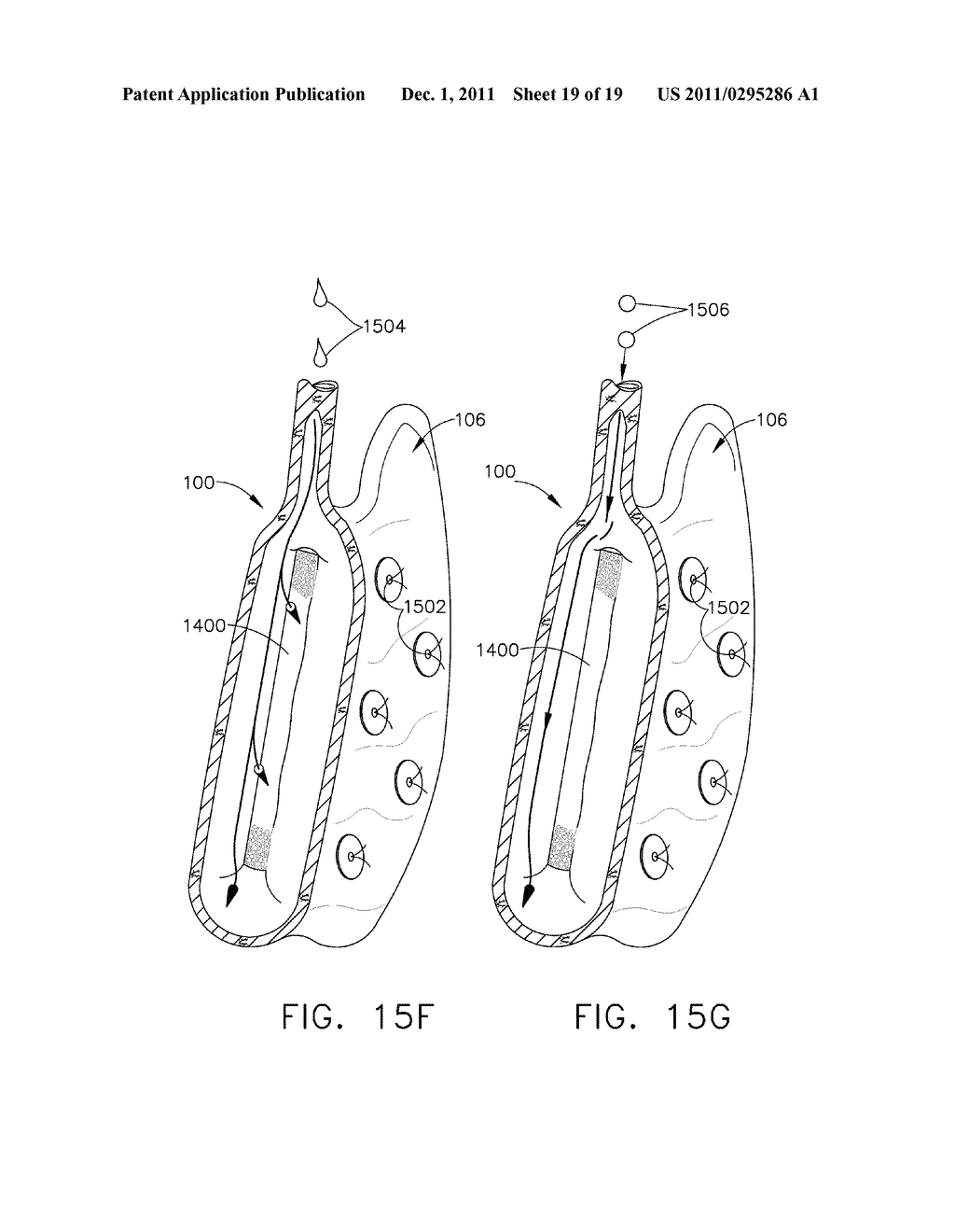 METHODS AND DEVICES FOR REGULATING THE ACTIVATION OF GHRELIN HORMONES     WITHIN A STOMACH - diagram, schematic, and image 20