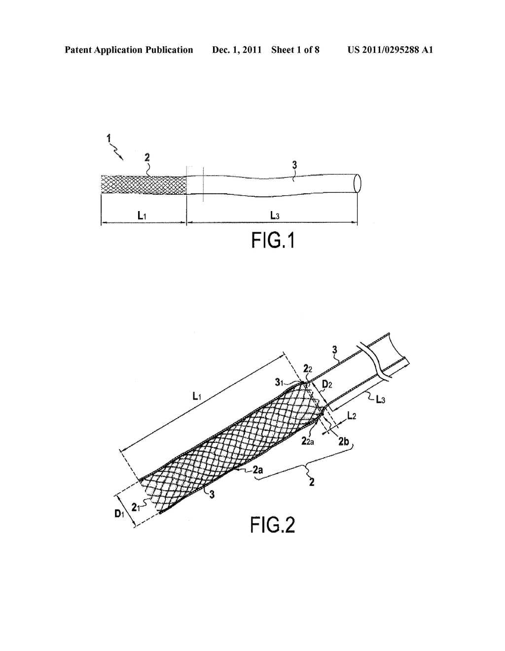 SURGICAL DEVICE FOR THE TEMPORARY PROTECTION OF ANASTOMOSIS - diagram, schematic, and image 02