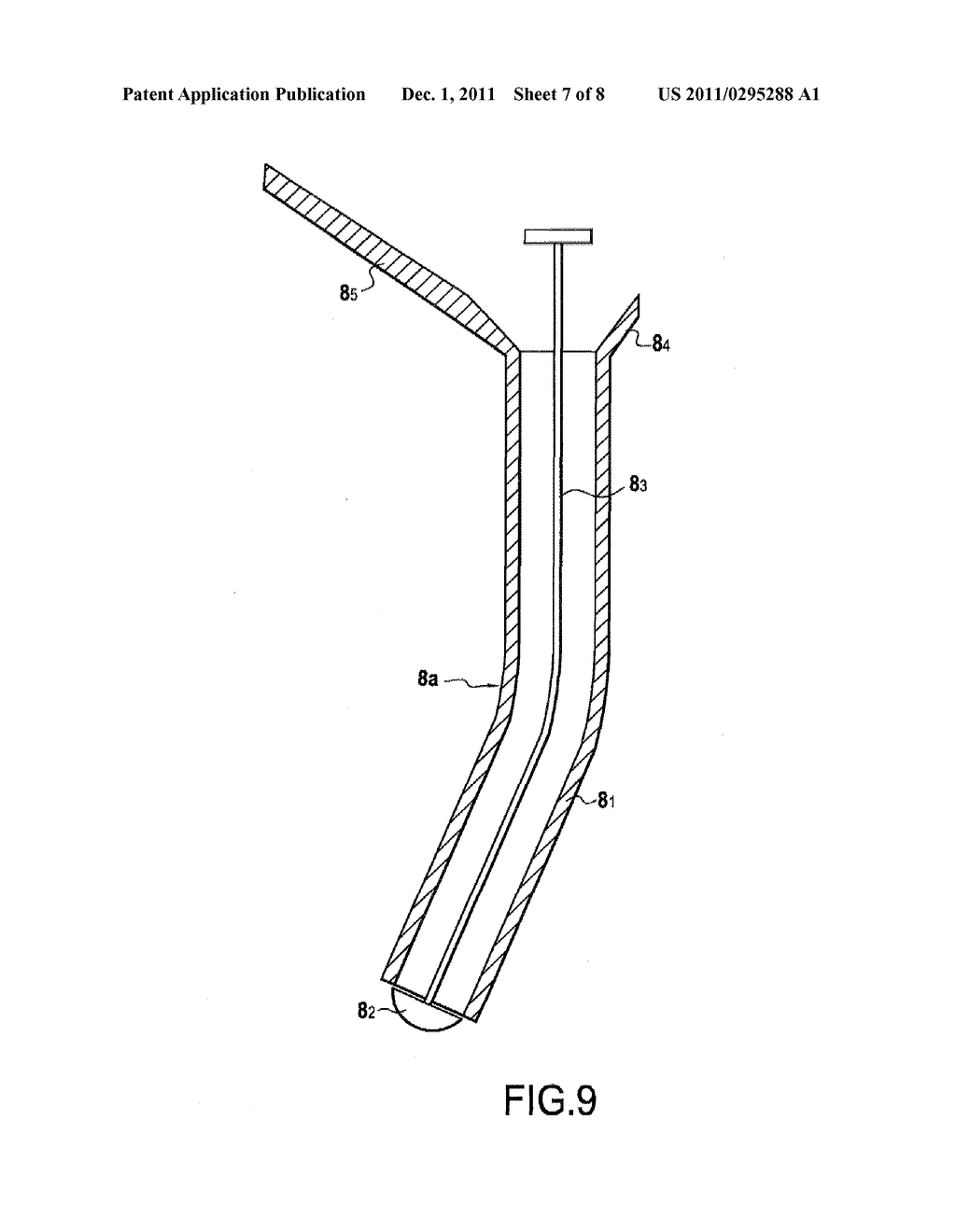SURGICAL DEVICE FOR THE TEMPORARY PROTECTION OF ANASTOMOSIS - diagram, schematic, and image 08