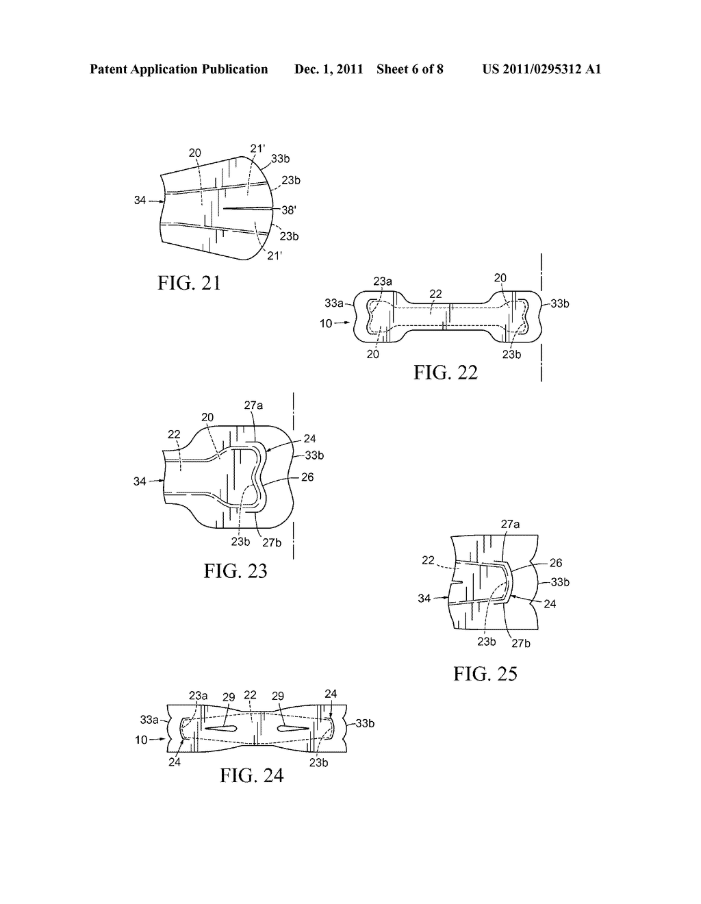 Nasal Dilator with Means to Direct Resilient Properties - diagram, schematic, and image 07