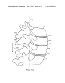 METHODS AND SYSTEMS FOR INCREASING THE BENDING STIFFNESS AND CONSTRAINING     THE SPREADING OF A SPINAL SEGMENT diagram and image