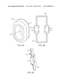 METHODS AND SYSTEMS FOR INCREASING THE BENDING STIFFNESS AND CONSTRAINING     THE SPREADING OF A SPINAL SEGMENT diagram and image